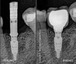 Radiografia da documentazione Advan
